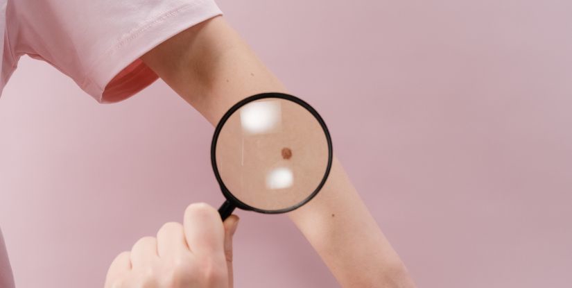 No-cost Skin Cancer Screenings